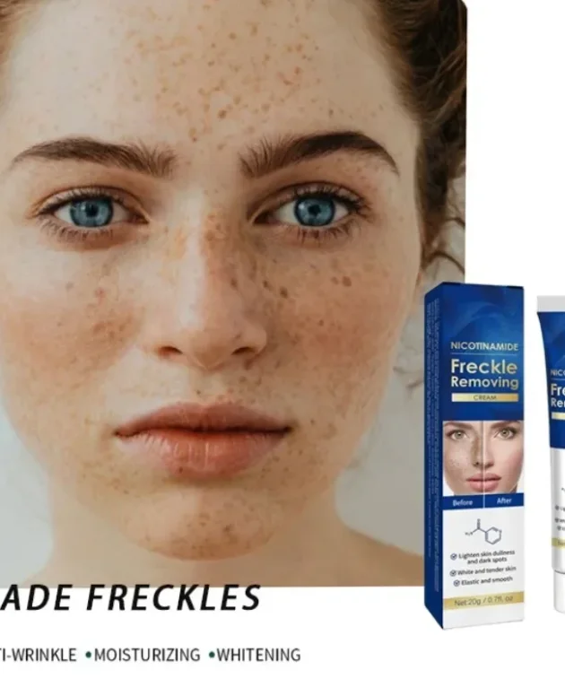 Dark Spot Remover for Face Removing Freckle target hyperpigmentation age spots sun spot Whitening MOISTURIZING skin beauty care